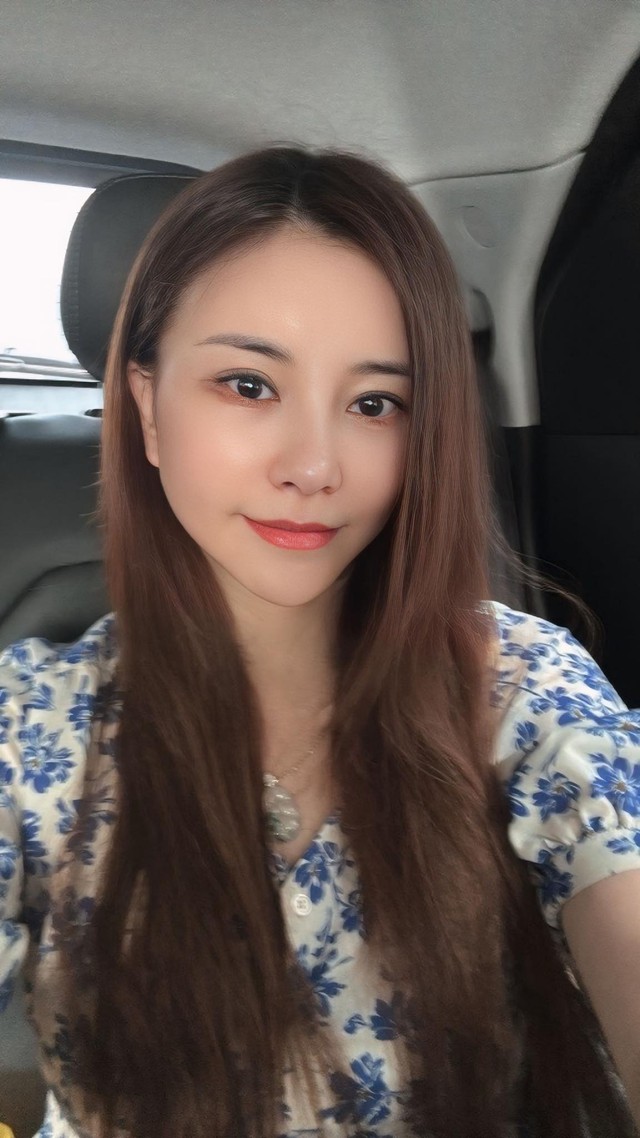 Kim Oanh phẫu thuật hạ mũi vì mong muốn nhìn trông mềm mại hơn