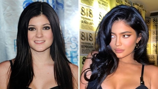 Hành trình thay đổi ngoại hình của Kylie Jenner