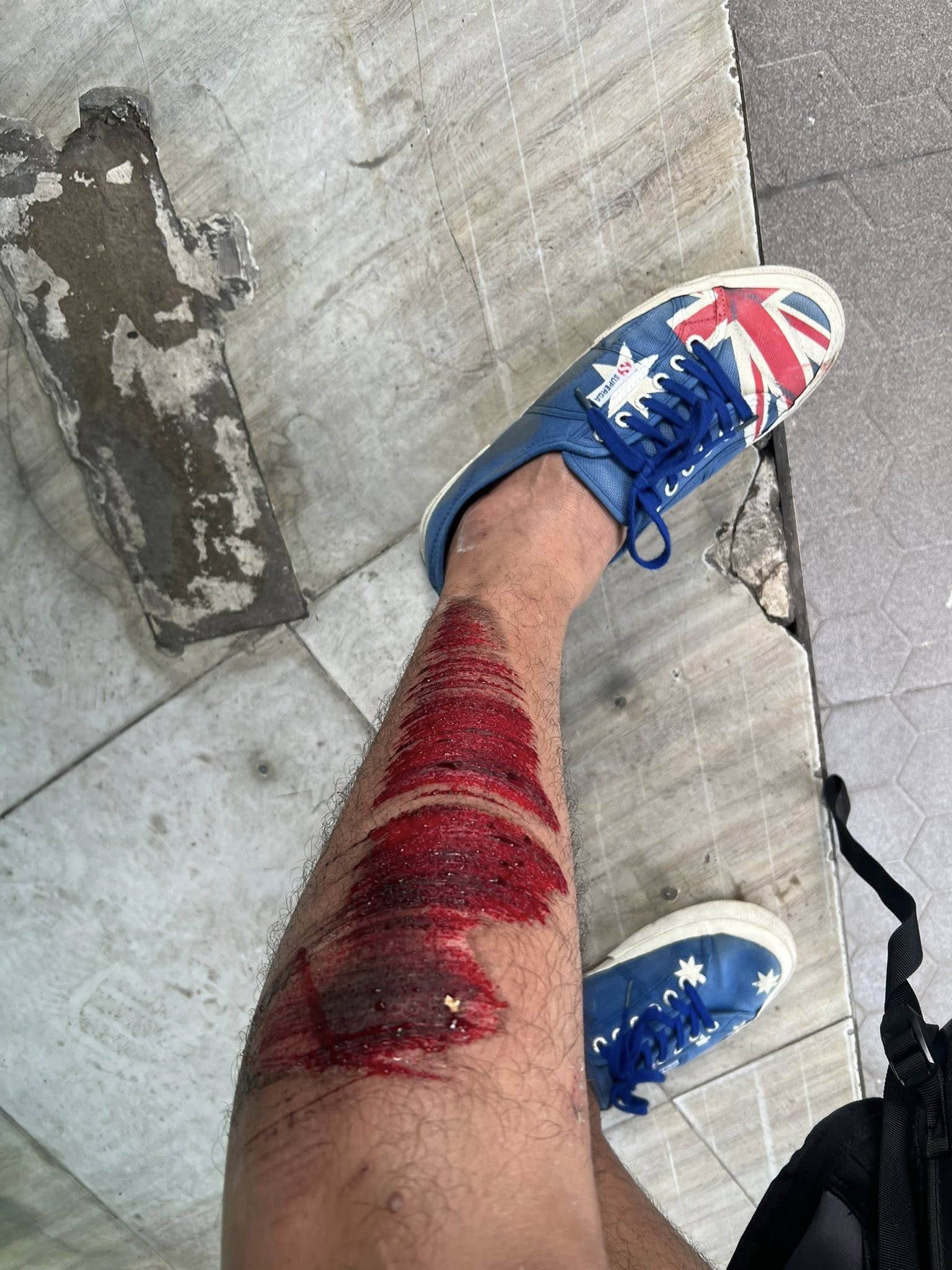 Diễn viên Quách Ngọc Tuyên gặp sự cố giao thông trong quá trình di chuyển đến phim trường