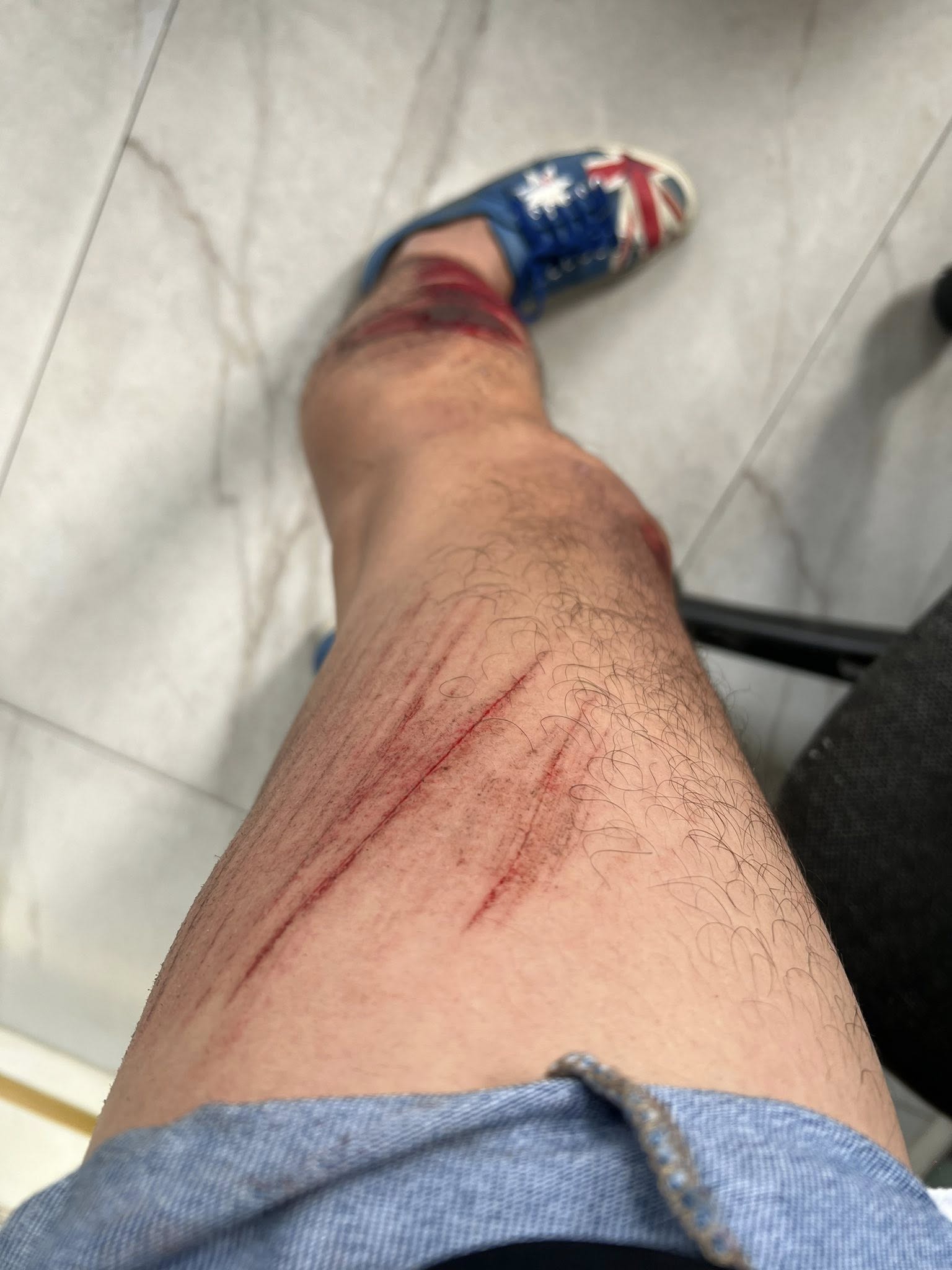 Anh đang điều khiển xe máy khi gặp tình huống bất ngờ